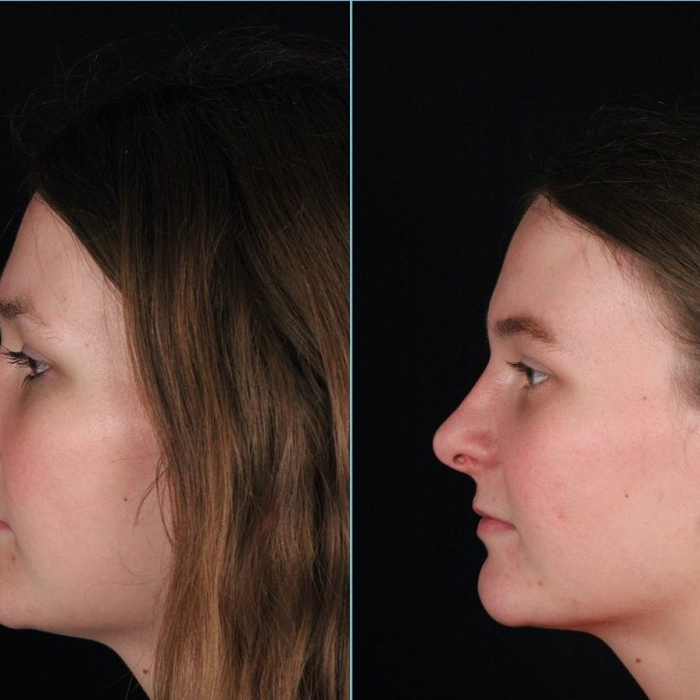 313074861_5673229792733023_2411995122000962722_n