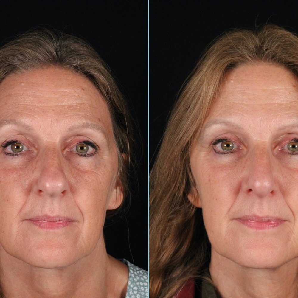 310431560_1457056458105253_110669032334428356_n